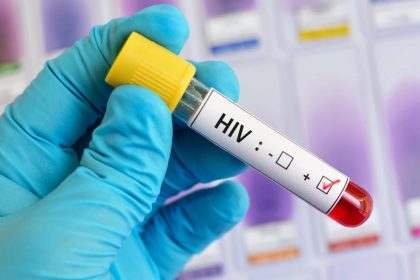 Προφυλακτική αγωγή κατά του HIV: Τώρα διαθέσιμη και στην Ελλάδα